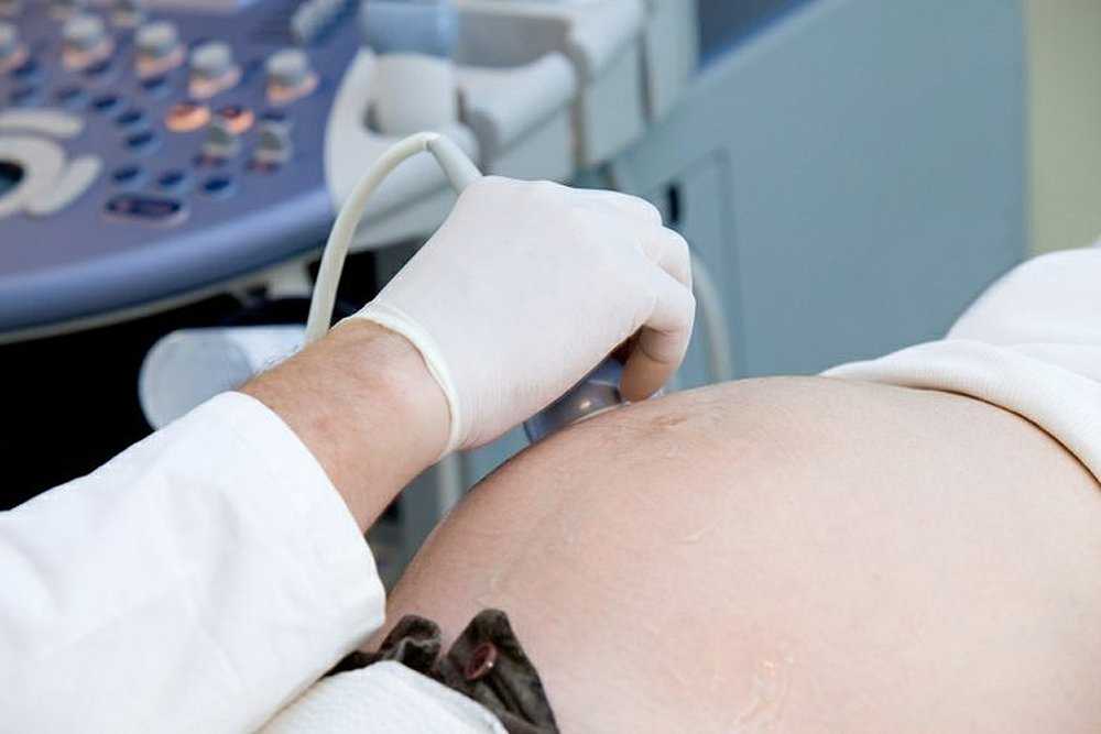 Узи почек диагнозы. Ультразвуковое исследование. УЗИ почек при беременности. УЗИ почек беременной. УЗИ почек при пиелонефрите беременных.