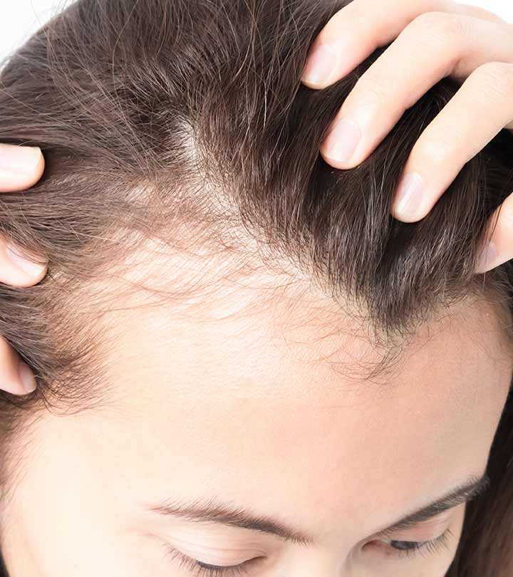 Психоэмоциональные нарушения у пациентов с выпадением волос :: врачам-специалистам