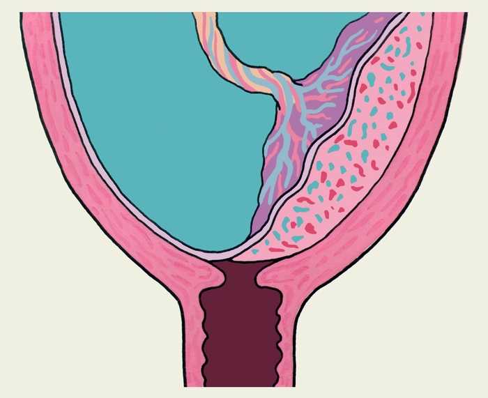 Низкая плацента при беременности: чем опасна и как рожать - статья репродуктивного центра «за рождение»