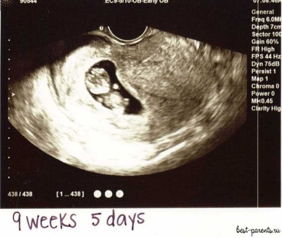 9 недель беременности – что происходит с малышом, мамой? 9 акушерская неделя беременности – развитие плода