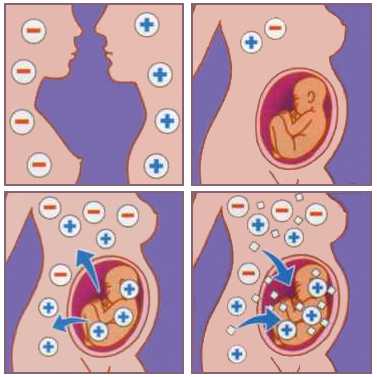 Резус фактор при беременности: причины, симптомы