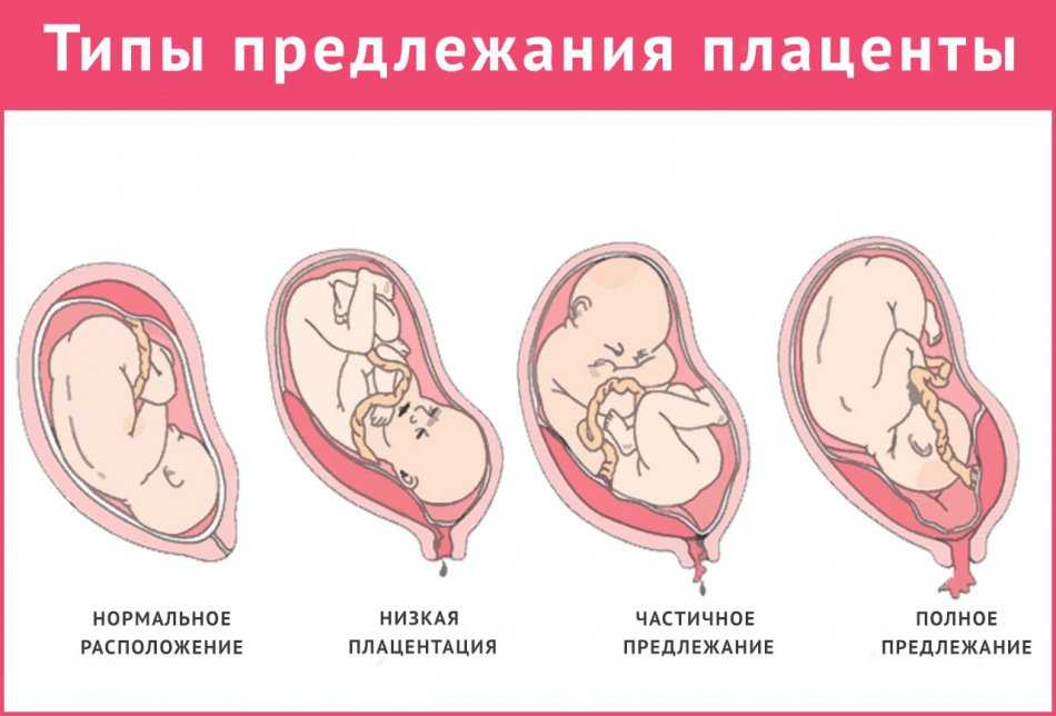 Можно ли заниматься спортом во время беременности - каким спортом заняться во время беременности - agulife.ru