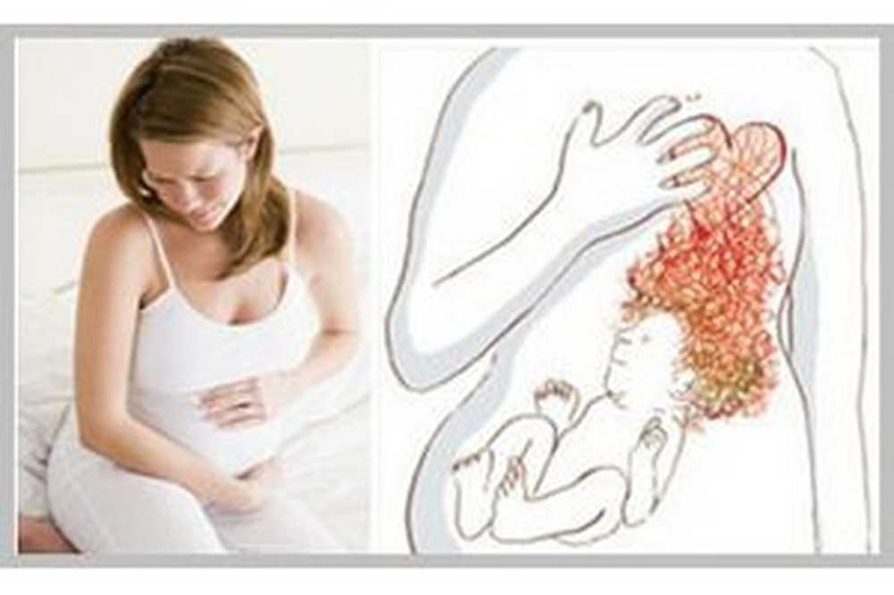 Изжога при беременности на ранних и поздних сроках: симптомы и причины, как лечить и корректировать питание