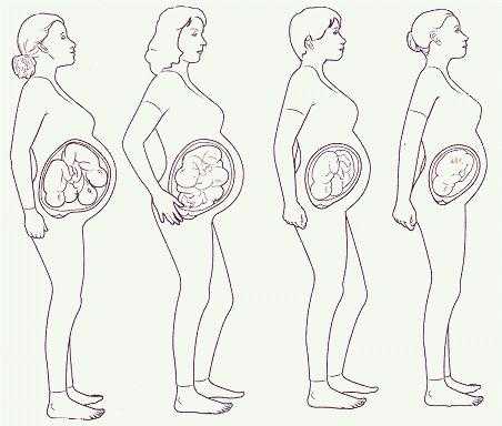 Как определить срок беременности | центр медицины плода на чистых прудах