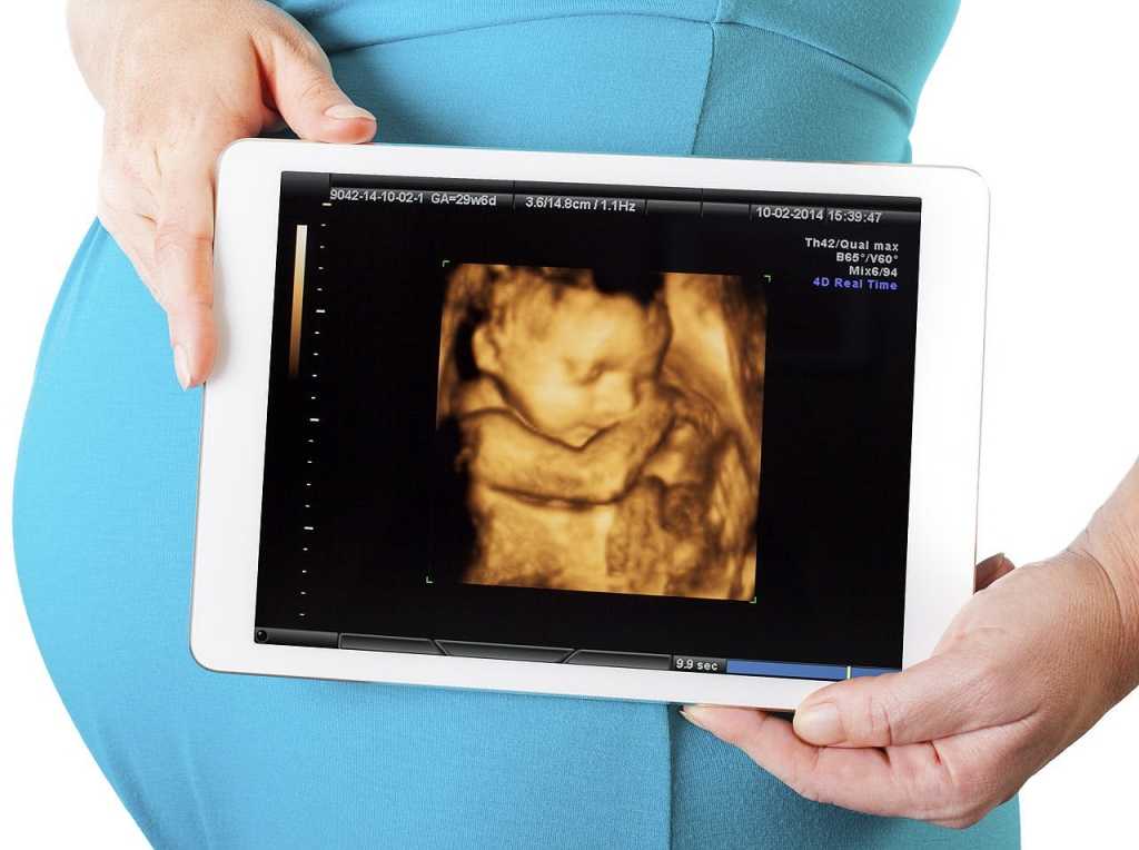 Как выглядит живот во время беременности по неделям: 34 фото из инстаграма