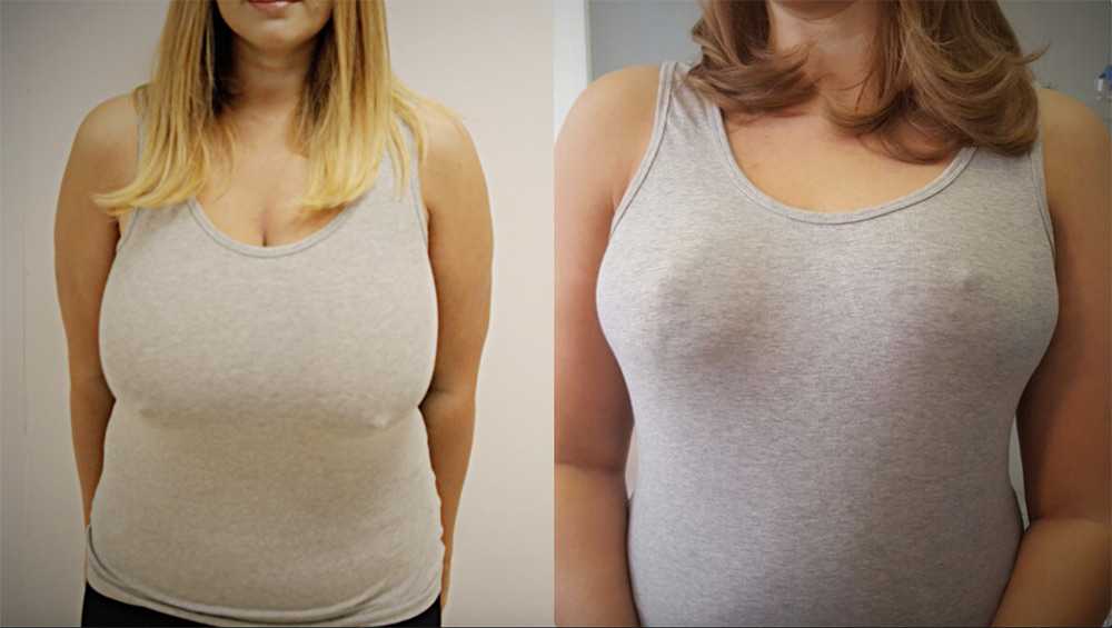 Как девушке подтянуть обвисшую грудь - упражнения для грудных мышц для женщин в домашних условиях, видео по подтяжке бюста, фото до и после