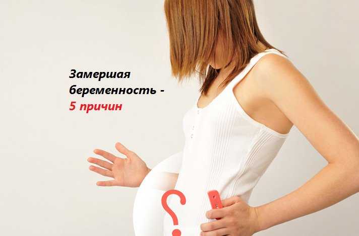 10 самых частых причин выкидыша на ранних сроках беременности   | материнство - беременность, роды, питание, воспитание