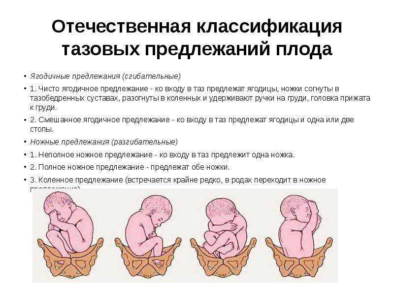 живот на 28 неделе беременности фото, 28 неделя беременности фото животиков, фото беременных на 28 неделе беременности