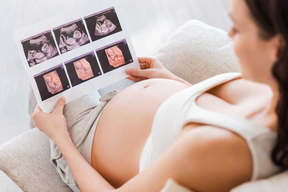 Беременность по неделям: развитие плода и ощущения женщины, снимки узи