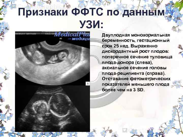Статусы про беременность в ожидании чуда | lovetrue.ru