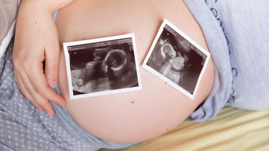 Как жить в ожидании двух полосок:  беременность шредингера