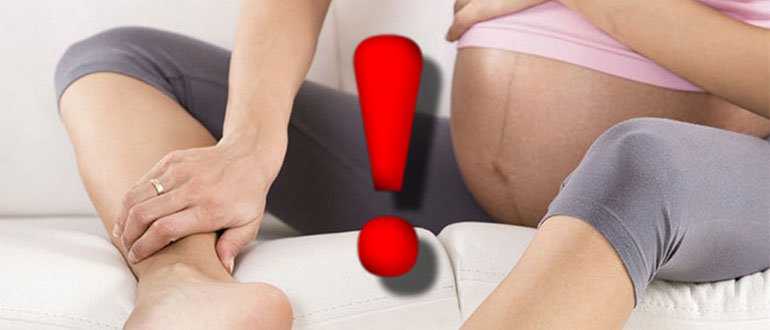 Отеки во время беременности. причины, профилактика, лечение отеков. варикоз, как следствие беременности.