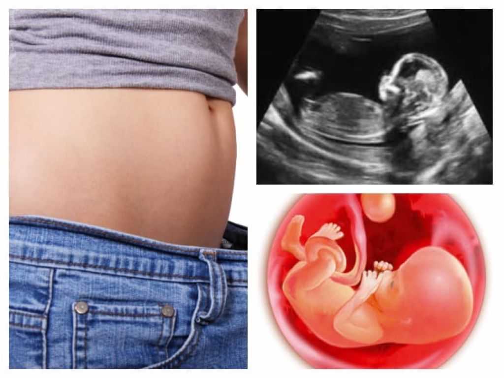 13 неделя беременности фото животиков, живот +на 13 неделе беременности фото, +как выглядит 13 неделе беременности фото