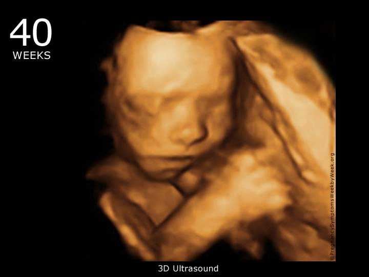 42 недели беременности, роды не начинаются: что делать?